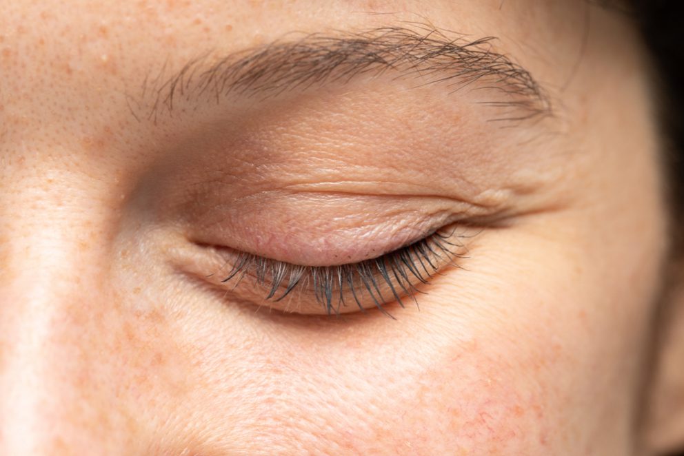 Voir Chirurgie des paupières ou blépharoplastie