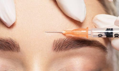 Voir Baby Botox pour la prévention des rides !