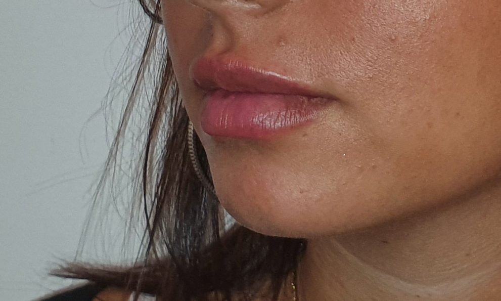 après