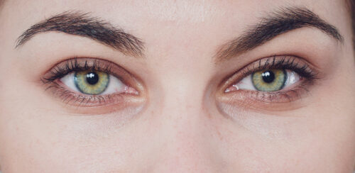 Voir Poches sous les yeux et cernes : quels traitements ?