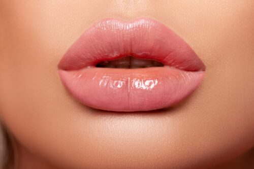 Voir Russian Lips Paris: des lèvres pulpeuses par injection