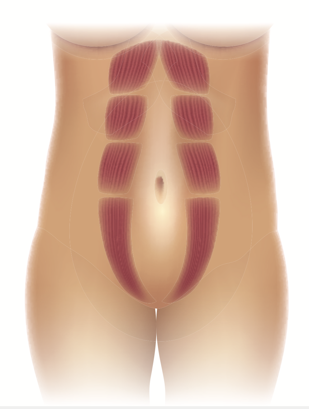 Diastasis & abdominoplastie : chirurgie réparatrice ventre