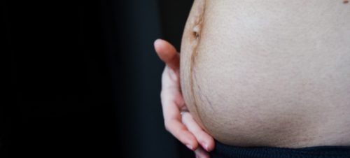 Voir Diastasis & abdominoplastie : chirurgie réparatrice ventre
