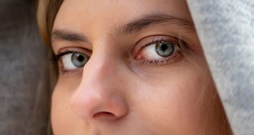 Voir Comment enlever une bosse sur le nez ?