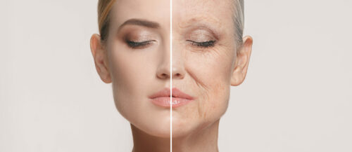 Voir Deep Plane Facelift : lifting cervicofacial à Paris