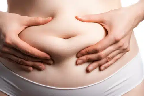 Voir Liposuccion du ventre ou abdominoplastie ?